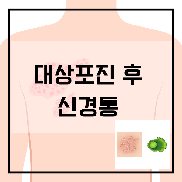 대상포진, 신경통, 발생 빈도, 통증